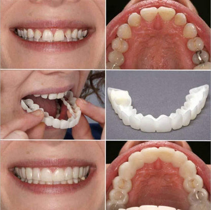 Fit Flex Cosmetic Teeth